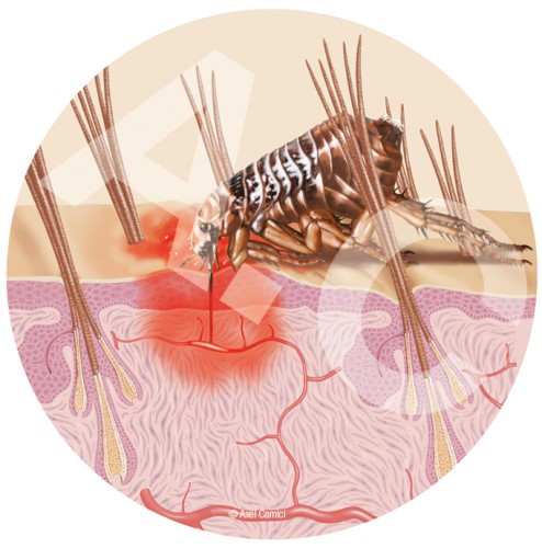 Ein Floh sticht durch die Haut bis zu einer kleinen Arterie. Illustrative Darstellung eines Hautschnittes im Bereich des Flohstiches.