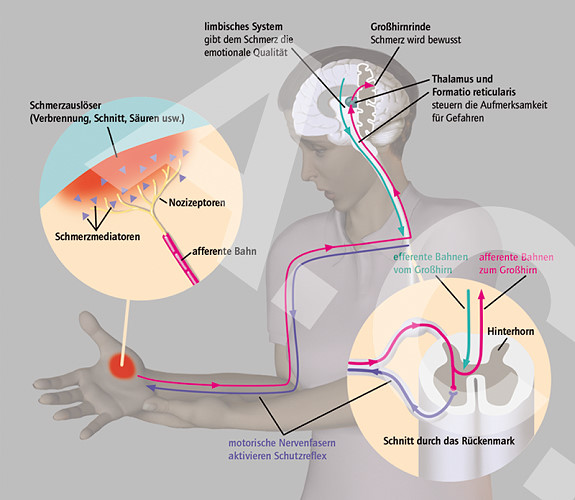 Illustrative Darstellung wie die Nervenleitung von Schmerzimpulsen über das Gehirn bis zur Abwehrreaktion verläuft.